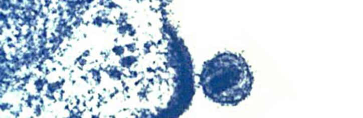 AIDS – Das Virus, das es nicht gibt