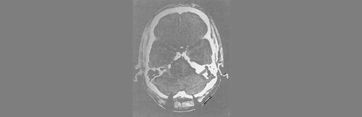 Wie 'AIDS'-Diagnose töten kann