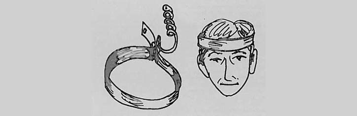 Akupunktur auf den Punkt gebracht (I)