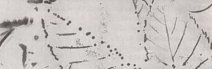 Nobelpreis für Elektroakupunktur?