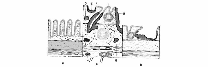 Sind Lebensmittel-Allergien ein Zeichen unserer Zeit?