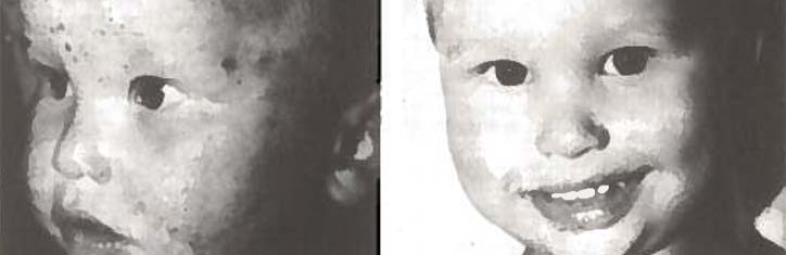 Hoffnung für Allergiker