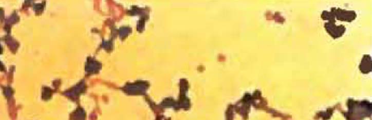 Blut-Mykosen: Wenn Pilze sich gegen den Wirt wenden