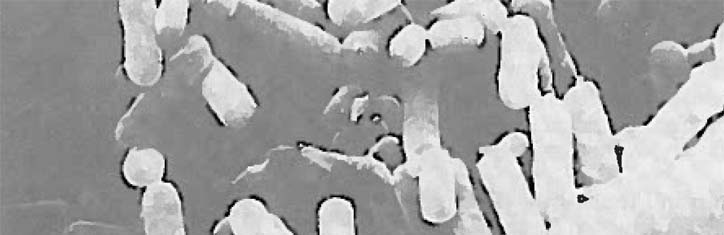 Der Darm, seine Bakterien und die Krebskrankheit