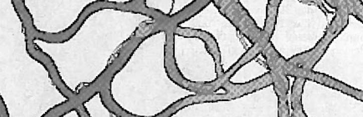 Die Gefahren der Eiweißspeicherung