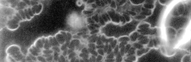 Das Chronische Erschöpfungssyndrom und mögliche Therapien