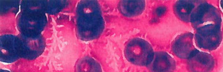 Wie krank ist unsere Gesundheit?