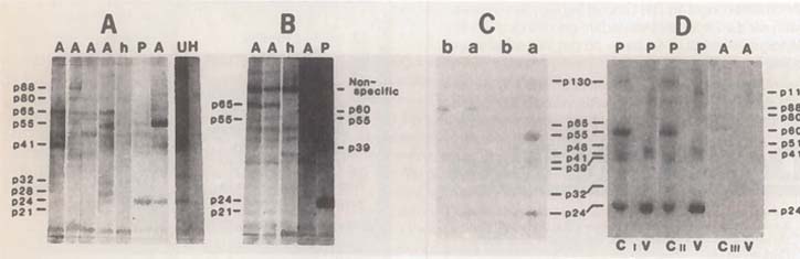 Australische Studie: HIV-Antikörpertests sind untauglich Teil 1