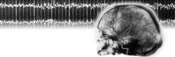 Wann der Mensch tot ist, beschließt der Bundestag