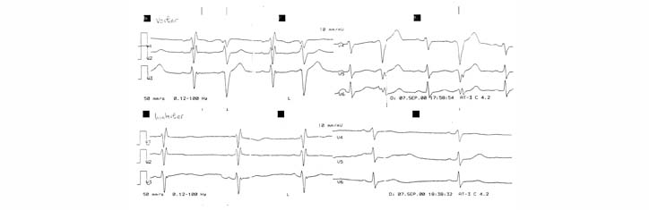 Weiterentwicklung von Kinesiologie und Radionik