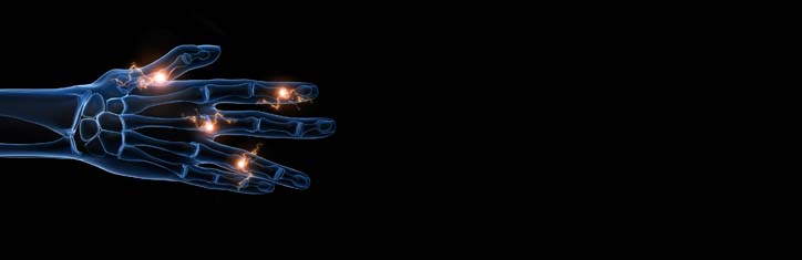 Gefährlichen Mikroentzündungen vorbeugen