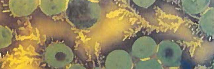 Die Wahrheit über Mykosen