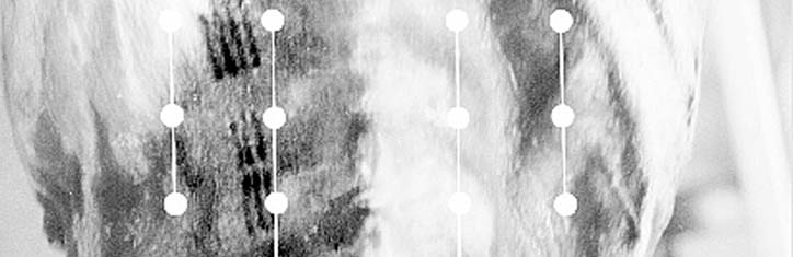 „Ötzi“, Körbler und die Neue Homöopathie