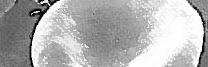 Die Dosierung in der Ozon-Sauerstoff-Therapie