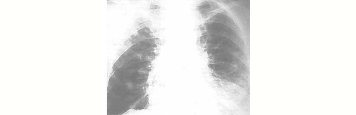 Universelle Sauerstoff-Mehrschritt-Therapie