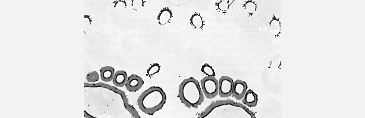 Sklerosen und Lähmungen homöopathisch behandelt