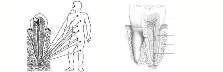 Störfeld Zahn: Energieräuber und Krankmacher