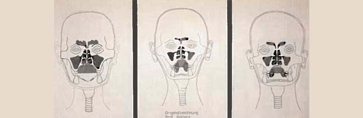 Werden die Zahnspangen überflüssig?